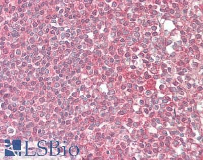 CD22 Antibody (aa707-847, clone 2B12, Carrier-free)