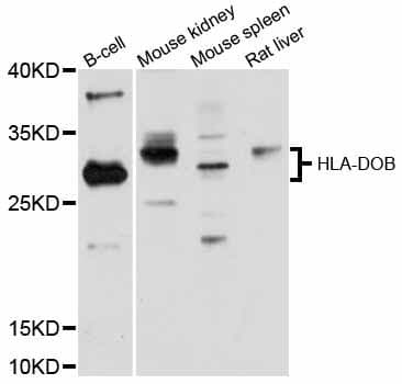 Polyclonal Rabbit anti-Human HLA-DOB Antibody (WB)