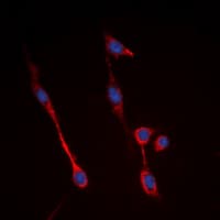 Polyclonal Rabbit anti-Human INSR / Insulin Receptor Antibody (C-Terminus, IHC, IF, WB)