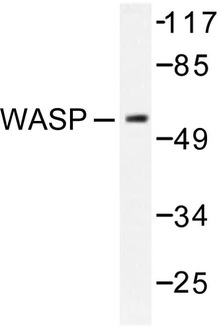 WAS / WASP Antibody (Glu284)