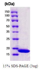Streptomyces avidinii Streptavidin Protein (Recombinant His)