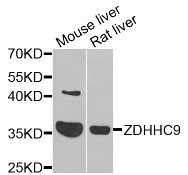 ZDHHC9 Antibody