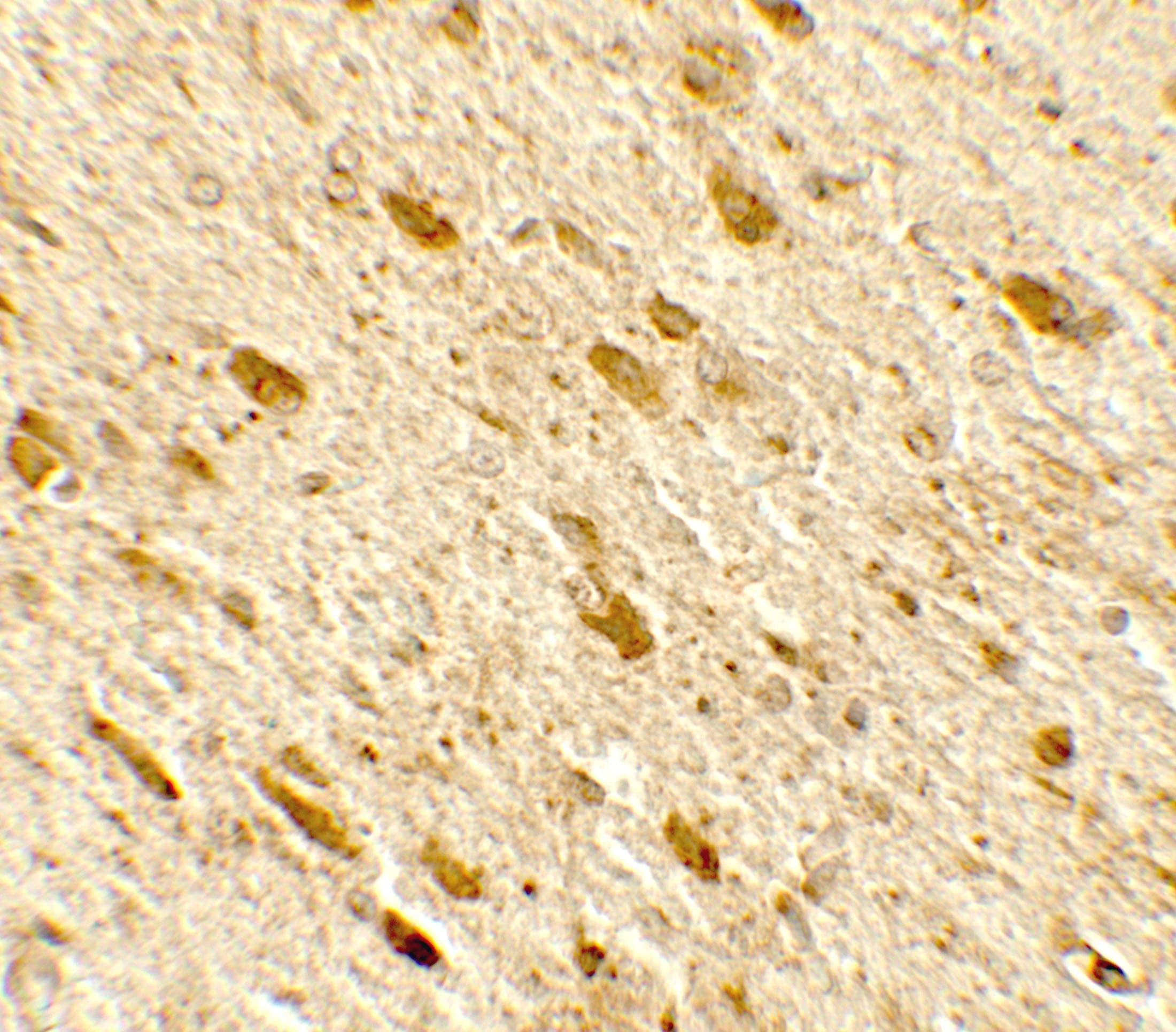 DENR / Density Regulated Antibody