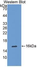 CAT / Catalase Antibody (Biotin)