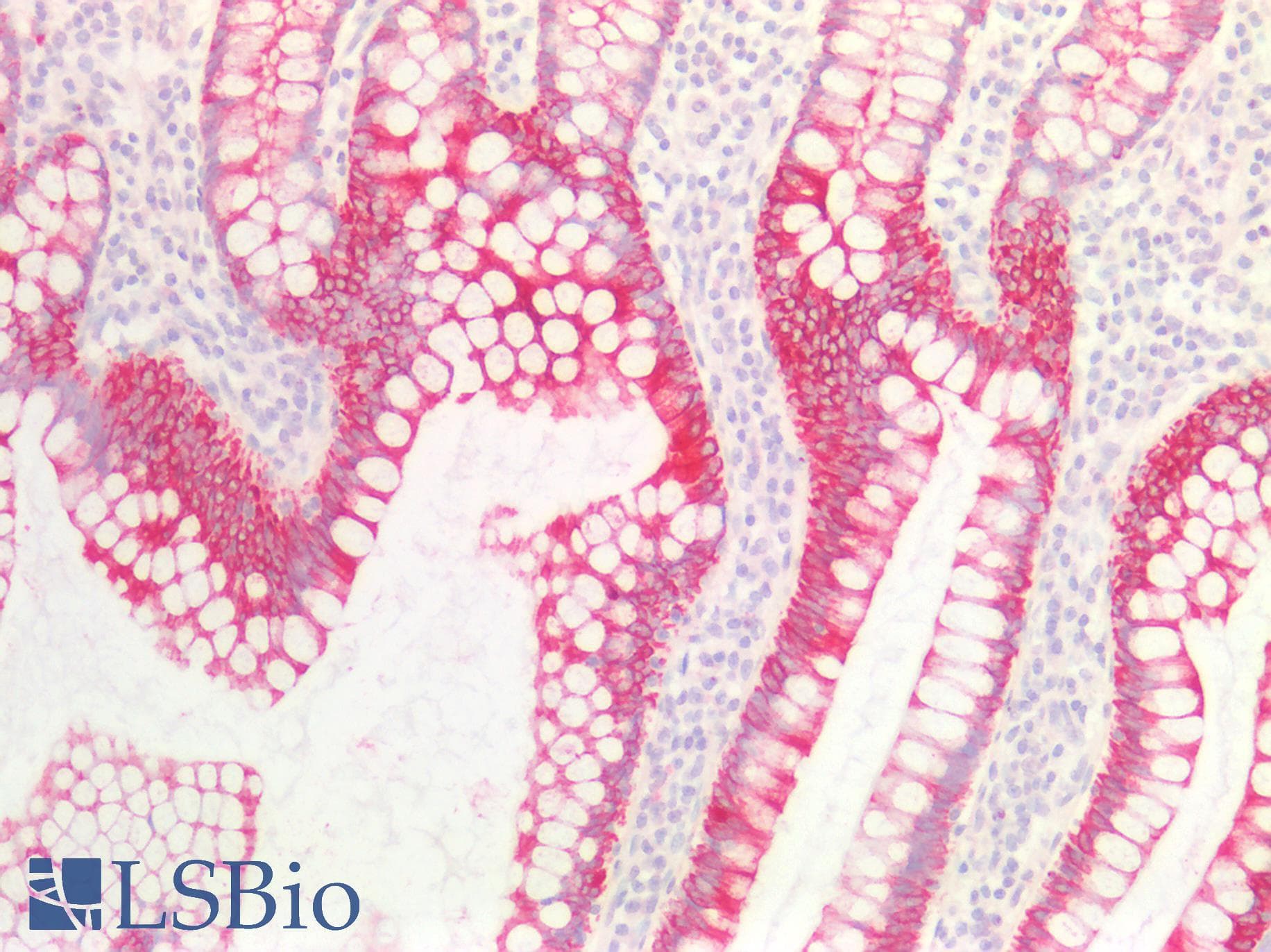 PathPlus™ KRT18 / CK18 / Cytokeratin 18 Antibody