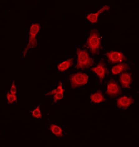 MBL2 / Mannose Binding Protein Antibody