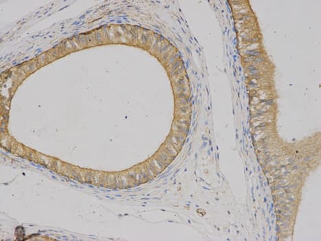 VEGFB Antibody