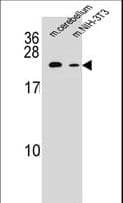 RAB12 Antibody (aa63-92)
