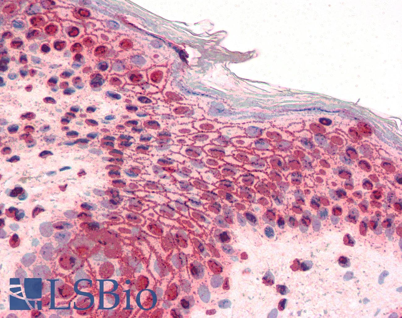 IHC-plus™ Polyclonal Rabbit anti-Human GLI2 Antibody (IHC, WB)