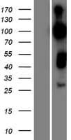 GARNL4 Protein (Over-Expression Lysate Myc-DDK (Flag))