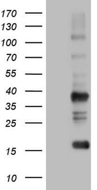 Monoclonal Mouse anti-Human TACC2 Antibody (clone OTI8G3, aa727-1026, WB)