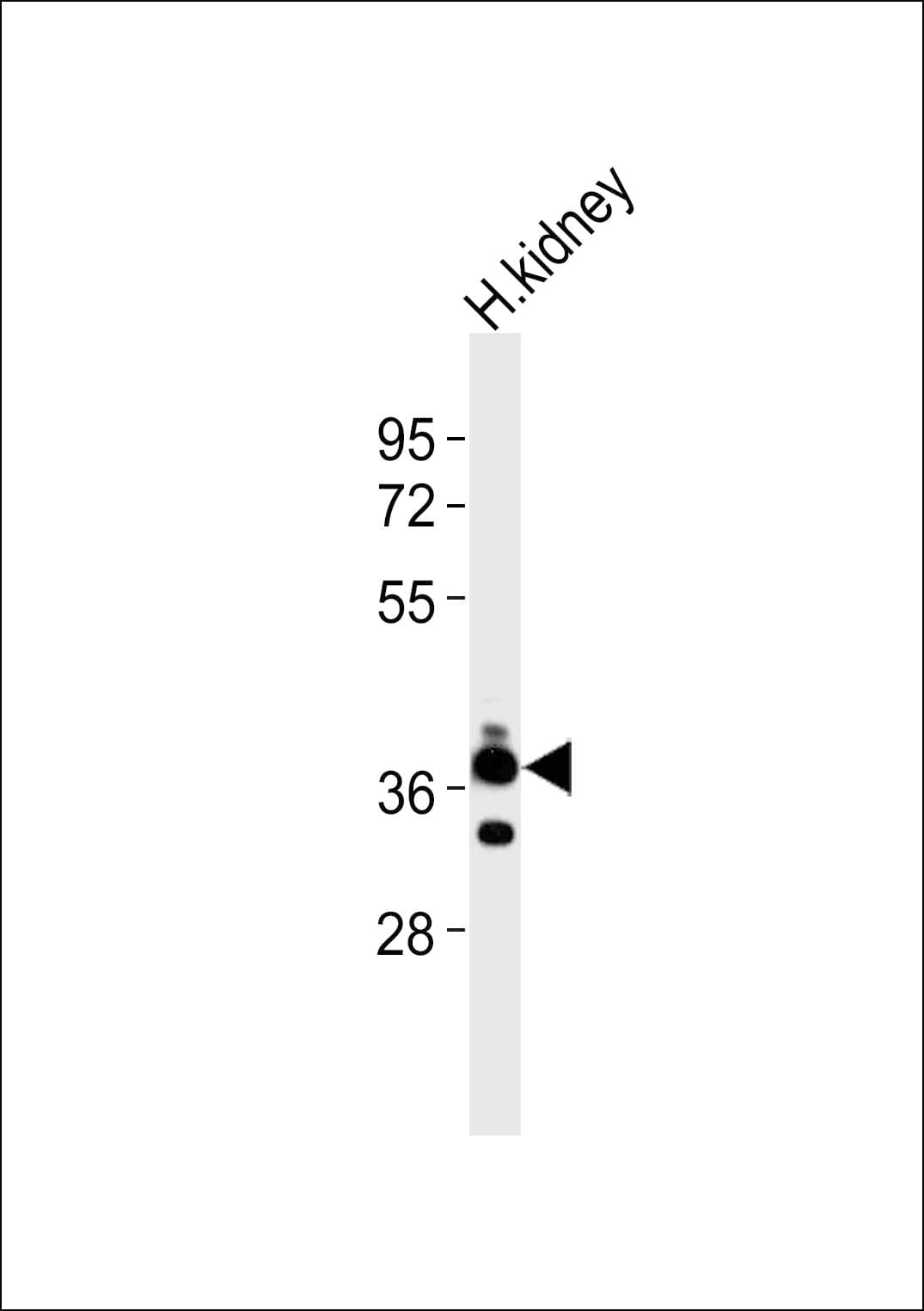 Polyclonal Rabbit anti-Human CD157 Antibody (WB)