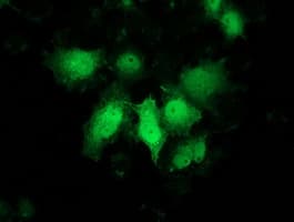 PNMT Antibody (clone OTI1F1, Carrier-free)
