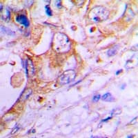 SFTPC / Surfactant Protein C Antibody