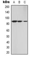 Polyclonal Rabbit anti-Human PRKG2 / CGKII Antibody (N-Terminus, IHC, WB)