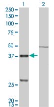 IHC-plus™ CTSK / Cathepsin K Antibody (clone 2F1)