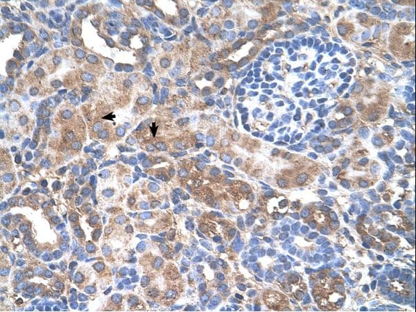 Polyclonal Rabbit anti-Human GALNT6 Antibody (aa61-110, IHC, WB)