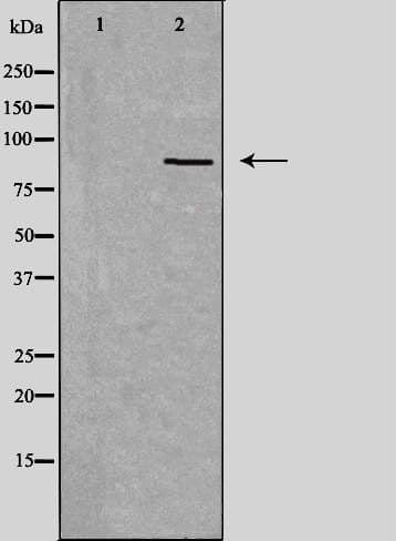 CDH18 / Ey-Cadherin Antibody