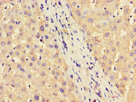 ASS1 / ASS Antibody