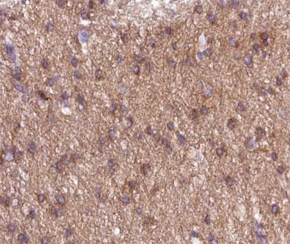 GRIN1 / NMDAR1 Antibody (phospho-Ser897)