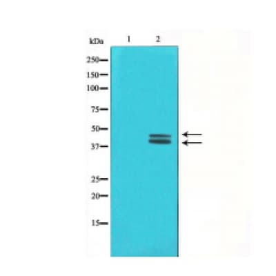 MAPK3 / ERK1 Antibody (phospho-Tyr204,pThr202)