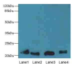 LRRC20 Antibody