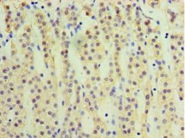CYP17 / CYP17A1 Antibody (aa24-508)