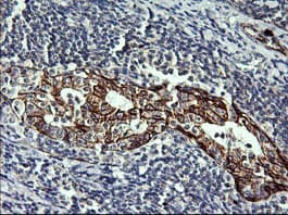 CDH3 / P-Cadherin Antibody (clone 2D5, Carrier-free)