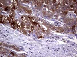GSTP1 / GST Pi Antibody (clone OTI4B6, Carrier-free)