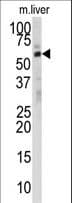 DHCR24 / Seladin-1 Antibody (aa57-87)