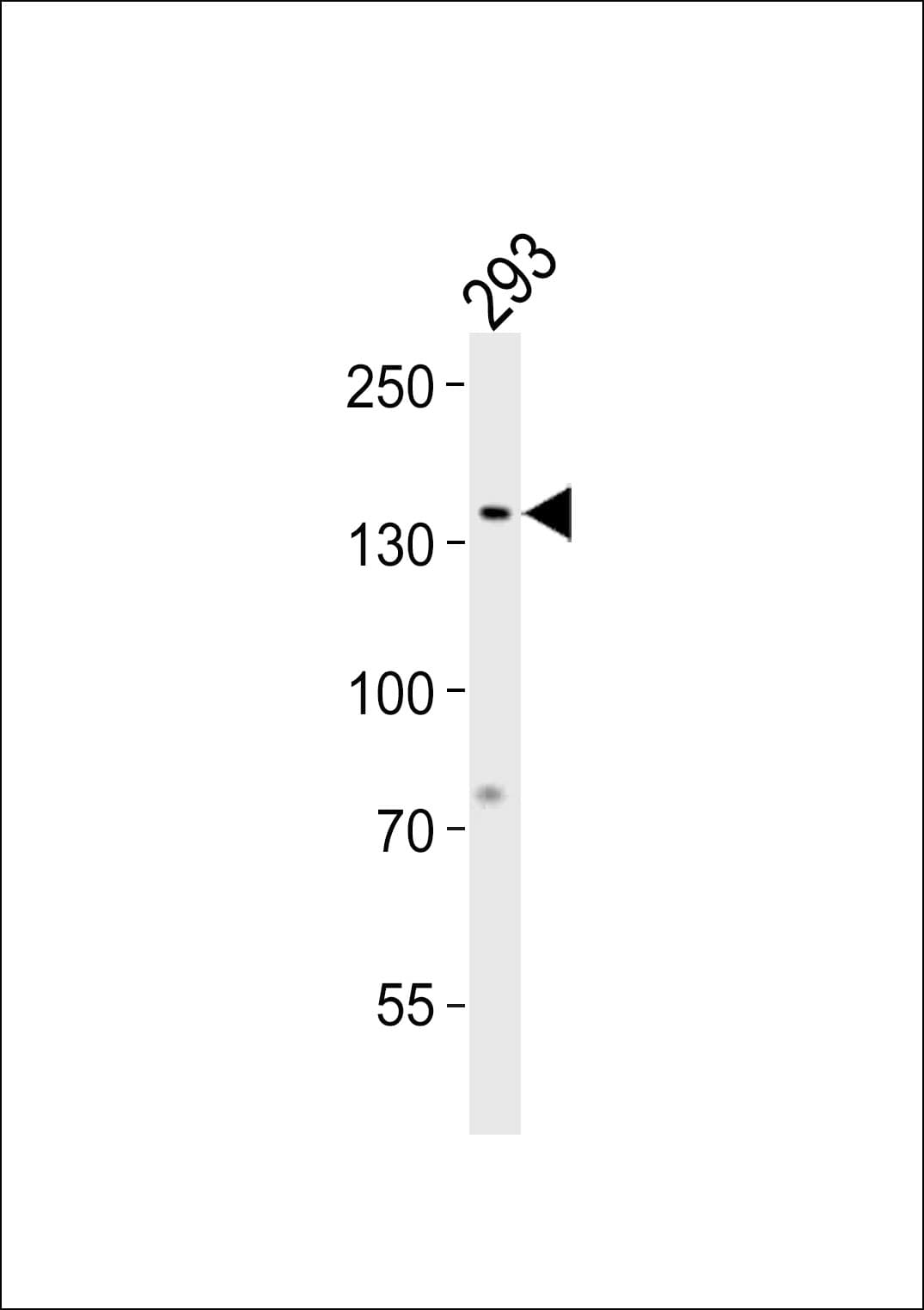 GTF2I / TFII I Antibody (aa281-310)