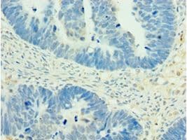 Polyclonal Rabbit anti-Human MEF2C Antibody (aa170-380, IHC)