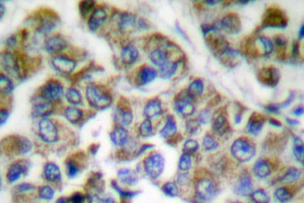 KRT14/KRT16 Antibody (Ser5)