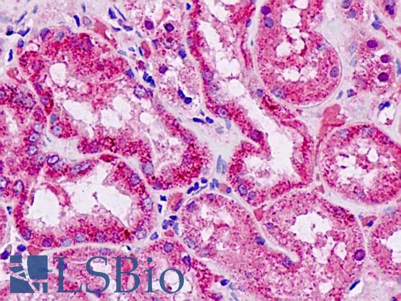 IHC-plus™ EFNA4 / Ephrin A4 Antibody (aa131-180)