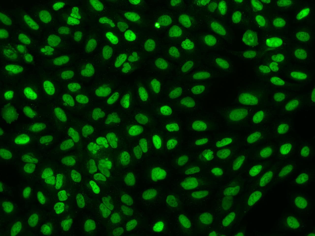 Polyclonal Rabbit anti-Human FAM111B Antibody (IF)