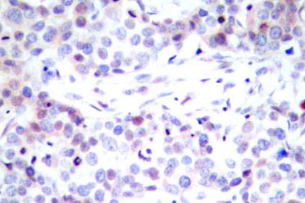 RELA / NFKB p65 Antibody (Gly530)
