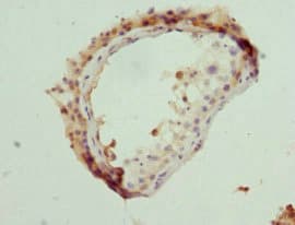 NLK Antibody