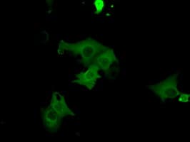 PKG / PRKG1 Antibody (clone OTI9G4)