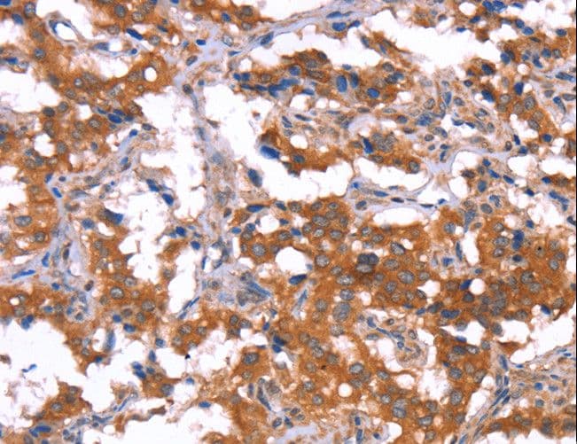 HCAR2 / NIACR1 Antibody