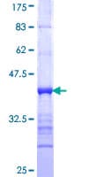 Human GRHL2 Protein (Recombinant GST, N-terminus)