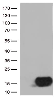 CSTB / Cystatin B / Stefin B Antibody (aa1-98, clone OTI5F2, Carrier-free)