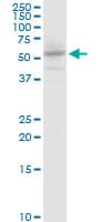 IHC-plus™ SLC13A5 Antibody (clone 2G4)