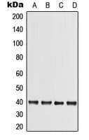 TRB3 / TRIB3 Antibody (N-Terminus)