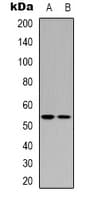 TP53 / p53 Antibody (Internal)