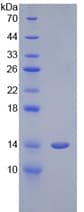 Human CST1 / Cystatin SN Protein (Recombinant His-S)