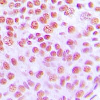 Cytokine IK Antibody (C-Terminus)