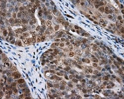 NPR3 Antibody (clone OTI11H5)