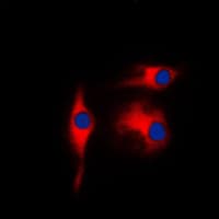 PathPlus™ ENO2 / NSE Antibody (C-Terminus)