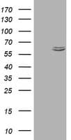 HSPD1 / HSP60 Antibody (clone OTI1B3)