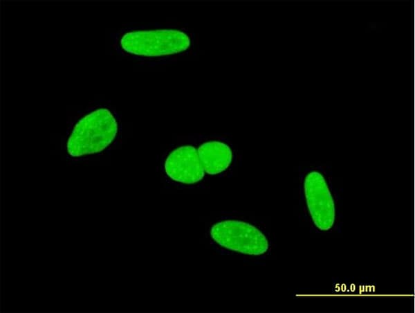 INTS6 Antibody (clone 3D9)